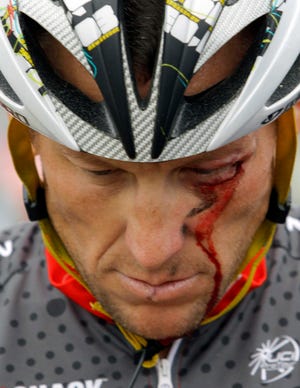 In this May 20, 2010 file photo, Lance Armstrong bleeds from a cut under his left eye after crashing during the fifth stage of the Tour of California cycling race in the outskirts of Visalia, Calif.