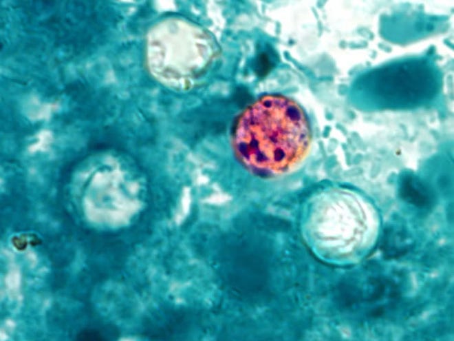 In this image provided by the Centers for Disease Control and Prevention, a photomicrograph of a fresh stool sample, which had been prepared using a 10% formalin solution, and stained with modified acid-fast stain, reveals the presence of four Cyclospora cayetanensis oocysts in the field of view.