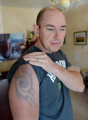 Jason Kravchuck displays the tattoo that his wife Eve Kravchuck, owner of Lase-Away in Westborough, is in the process of removing. D