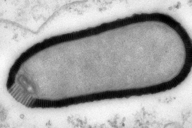 This electron microscope image provided by researchers in March 2014 shows a section of a Pithovirus particle, dark outline, inside an infected Acanthamoeba castellanii cell. The length of the particle is about 1.5 microns with a 0.5 micron diameter. Researchers have revived the virus, which is more than 30,000 years old, after finding it in the permafrost of northeast Siberia. While it poses no threat to people, its recovery suggests that dangerous germs might emerge in the future as permafrost thaws because of global warming or mineral exploration, researchers suggested Monday, March 3, 2014 in the Proceedings of the National Academy of Sciences. (AP Photo/IGS, CNRS-AMU, Julia Bartoli, Chantal Abergel)