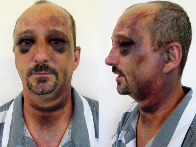 Jody Holland says he was hit, choked and had his head slammed into concrete by deputies at the DeSoto County jail. (PHOTOS PROVIDED BY THE HOLLAND FAMILY)
