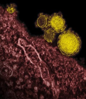 This undated electron microscope image made available by the National Institute of Allergy and Infectious Diseases - Rocky Mountain Laboratories shows novel coronavirus particles, also known as the MERS virus, colorized in yellow. On Saturday, May 17, 2014 the U.S. Centers for Disease Control and Prevention said an Illinois man has apparently picked up an infection from the only American diagnosed with a mysterious Middle East virus, but the man has not needed medical treatment. (AP Photo/NIAID - RML, File)
