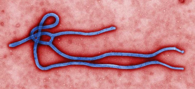 FILE - This undated file image made available by the CDC shows the Ebola Virus. As a deadly Ebola outbreak continues in West Africa, health officials are working to calm fears that the virus easily spreads, while encouraging those with symptoms to get medical care. (AP Photo/CDC, File)