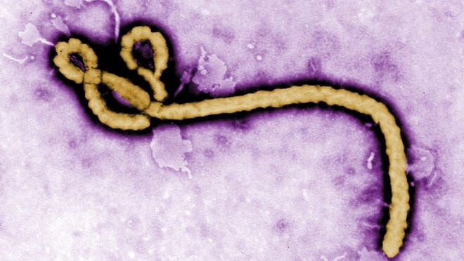 A colorized transmission electron micrograph image shows an Ebola virus.