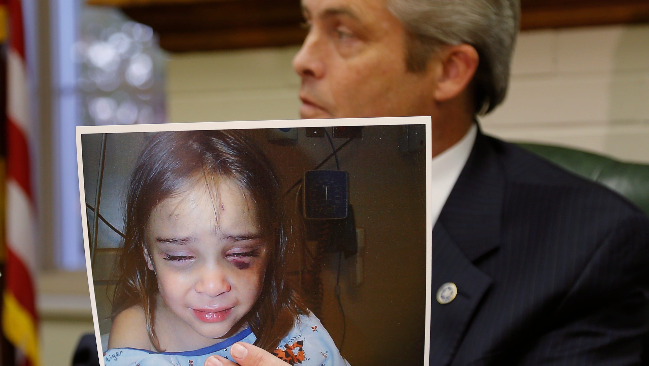 Pottawatomie County District Attorney Richard Smothermon revealed in 2012 that DHS workers kept this hospital photo of Serenity Deal from the judge who placed her with her father. The photo was taken after she was returned to a foster home from a visit with her father in January 2011. DHS workers accepted the father’s explanation that she fell. Photo by Bryan Terry, The Oklahoman Archives BRYAN TERRY - THE OKLAHOMAN