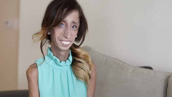 Lizzie lucha por inspirar a otros y lograr sus metas Lizzie lucha por inspirar a otros y lograr sus metas