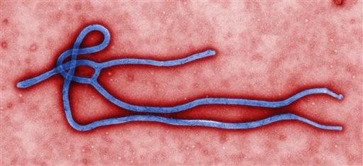 FILE - This undated file image made available by the CDC shows the Ebola Virus. U.S. health officials have warned for months that someone infected with Ebola could unknowingly carry the virus to this country, and on Tuesday, Sept. 30, 2014, came word that it had happened: A traveler in a Dallas hospital became the first patient diagnosed in the U.S. (AP Photo/CDC, File)