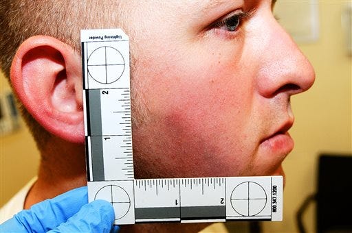 This undated photo released by the St. Louis County Prosecuting Attorney's office on Monday, Nov. 24, 2014, shows Ferguson police officer Darren Wilson during his medical examination after he fatally shot Michael Brown, in Ferguson, Mo. According to a medical record released as part of the evidence presented to the grand jury that declined to indict Wilson in the fatal shooting, doctors diagnosed Wilson with a facial contusion. (AP Photo/St. Louis County Prosecuting Attorney's Office)