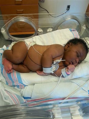 This photo provided by the St. Joseph's Womens Hospital shows Avery Denton, the 14.1-pound baby born at the hospital in Tampa on Jan. 29, 2015. The hospital says the infant is the heaviest born at the hospital, and one of the largest born in the state. After 18 hours of labor, Ford naturally delivered Avery, who remains in neonatal intensive care but is expected to go home soon. (AP Photo/St. Joseph's Womens Hospital)