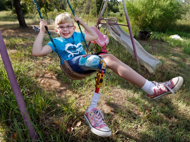 Oklahoma third-grader Hope Smith walks — and also does handstands and cartwheels and participates in bowling, skating and most of the other physical things 8-year-olds do — with the aid of a leg prosthesis, one of several she has been fitted with growing up. She was born with tibial hemimelia, or the lack of a tibia, in her right leg. [Photo by Steve Sisney, The Oklahoman]