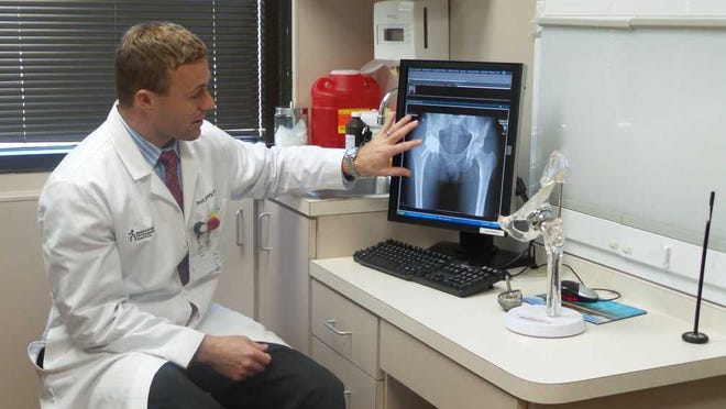 Courtesy of Baptist Health Brett Frykberg, orthopedic surgeon for Jacksonville Orthopaedic Institute/Baptist Health, looks at an X-ray of a patient who received a Birmingham Hip Resurfacing. The procedure allows patients to keep more of their own bone.