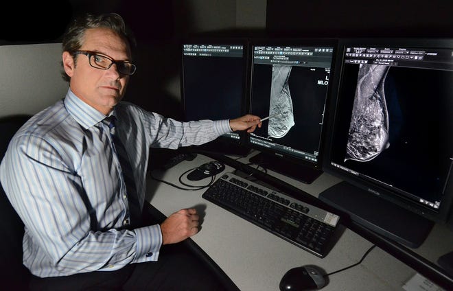 Dr. Nick Maravich, a radiologist with Larchmont Imaging in Moorestown, explains how the 3-D mammogram (left) shows a spiculated mass in a breast that was not truly detected with a regular 2-D mammogram, shown on the right.