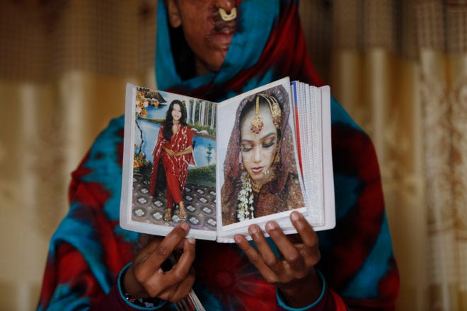 In this photo taken on Jan. 27, 2016, Sidra Kamwal shows pictures of herself before she was disfigured in an acid attack in Karachi, Pakistan. She had left her abusive husband and moved back in with her mother when another man proposed to her. The man refused to take no for an answer. He pestered her and harassed her. And then one day when she was at work he told her that if couldn’t have her, no one could, and threw acid in her face.(AP Photo/Shakil Adil)