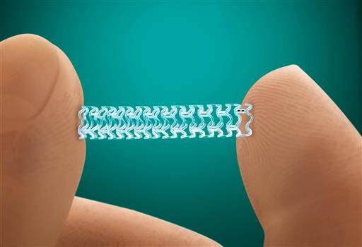 This photo provided by Abbott Laboratories shows the company's Absorb stent. On Tuesday, July 5, 2016, the Food and Drug Administration approved the slowly-dissolving medical implant for treating clogged arteries. The new stent is designed to dissolve over three years. Currently-available stents are permanent, mesh-wire tubes that hold open arteries after a procedure used to clear fatty plaque.