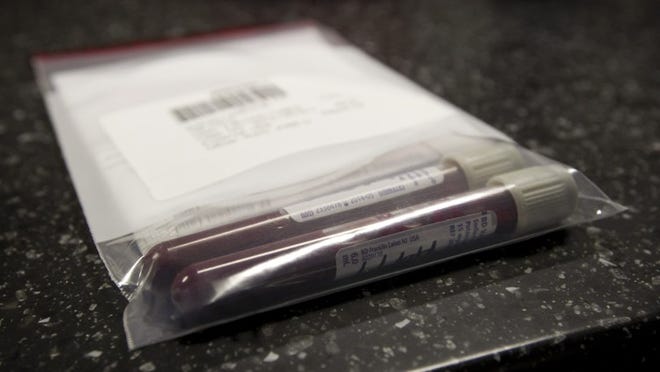 A blood sample from a DWI suspect is stored in the Austin Police Department breath alcohol testing bus parked at House Park during a “no refusal” day in 2013.