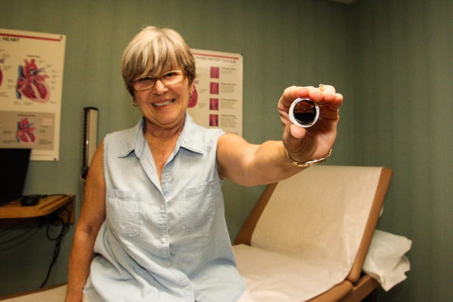 Virginia Arena, 65, from Palm Coast, shows a sample of the new On-X valve used in her open heart surgery. The valve requires a lower dose of the blood thinner Coumadin than other mechanical valves. News-Journal / LOLA GOMEZ