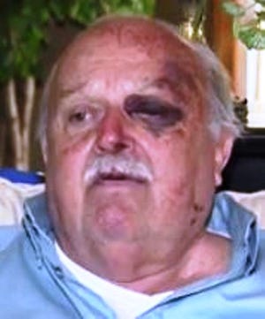 This screen grab show Al Marceau, 79, of Florida, who says he was attacked by a group of people at the Comfort Inn and Suites in Fall River after he told them to quiet down in the hallway in the early-morning hours.