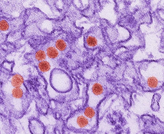 A digitally colored election microscope image shows the Zika virus in red. (Cynthia Goldsmith/CDC via AP)