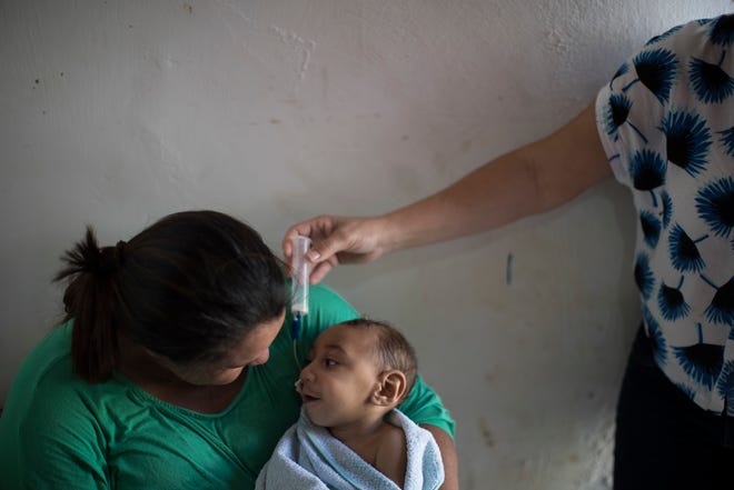 In this Sept. 27, 2016 photo, Solange Ferreira holds her son Jose Wesley Campos as family friend Sandra Souza, right, holds his nasogastric feeding tube during his 1-year birthday party at his home in Bonito, Pernambuco state, Brazil. Learning how to feed is the Jose’s latest struggle as medical problems mount for him and many other infants born with small heads to mothers infected with the Zika virus in Brazil. (AP Photo/Felipe Dana)