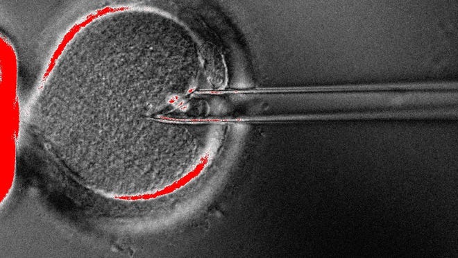 In this undated photo provided by OHSU Center for Embryonic Cell and Gene Therapy, scientists use a pipette to remove the nucleus from an egg. Britain’s fertility regulator has approved controversial techniques allowing doctors to create babies using DNA from three people â€” what it called a “historic” decision to help prevent a small number of children from inheriting potentially fatal diseases from their mothers. (OHSU Center for Embryonic Cell and Gene Therapy via AP)