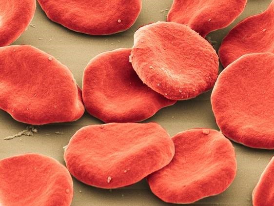 This photo provided by the University of Pittsburgh, Center for Biologic Imaging shows colorized scanning electron micrograph of red blood cells. (University of Pittsburgh, Center for Biologic Imaging via AP)