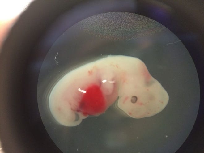 This undated photo provided by the Salk Institute on Jan. 24, 2017 shows a 4-week-old pig embryo which had been injected with human stem cells. The experiment was a very early step toward the possibility of growing human organs inside animals for transplantation. (Salk Institute via AP)