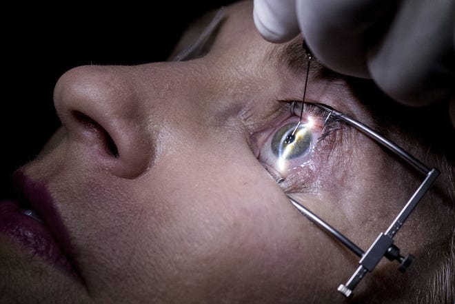 Dr. Mark Whitten inserts a Raindrop inlay in the eye ofChristianne Krupinsky to reshape it for better close-up focus. [The Associated Press]