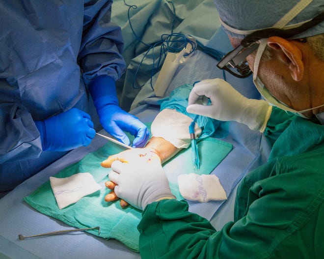 Dr. Mark Wertman performs a carpal tunnel procedure at CarolinaEast Medical Center. [Bill Hand/Sun Journal Staff]