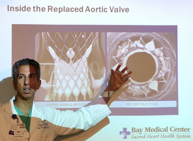 Dr. Amir Haghighat explains a new heart procedure now offered at Bay Medical Sacred Heart in Panama City on Monday. [ANDREW WARDLOW/THE NEWS HERALD]