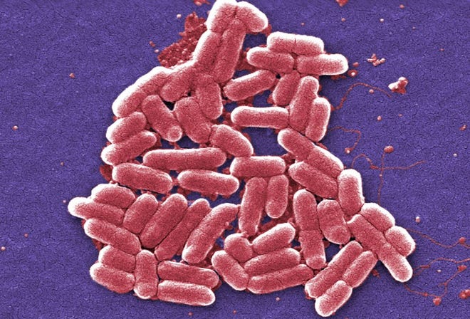 This 2006 colorized scanning electron micrograph image made available by the Centers for Disease Control and Prevention shows the O157:H7 strain of the E. coli bacteria.