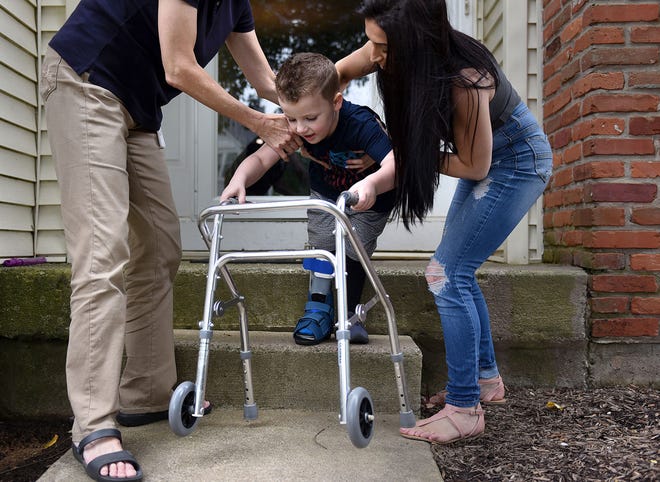 Physical therapist Katherine Johnson and Anthony DeCristoforo's mother, Lisa, help him navigate steps during a physical therapy session Wednesday, June 7, 2017, at his Falls home.