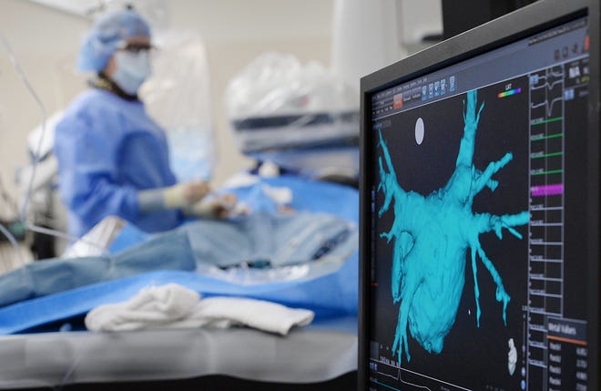 Kelly Hayes, M.D., background, uses different forms of imaging, including a 3D map of the heart, right, as she performs cryoablation at UPMC Hamot recently. [GREG WOHLFORD/ERIE TIMES-NEWS]