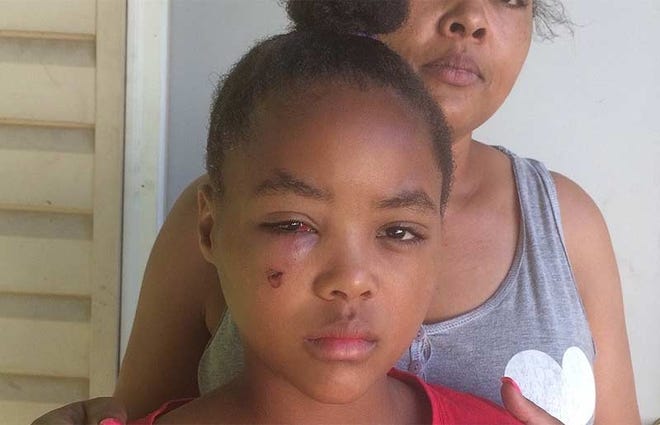 The cheek of 9-year-old Maniya Cannon was grazed by a bullet that was fired into her North Linden house as she slept on July 4. [Earl Rinehart/Dispatch]