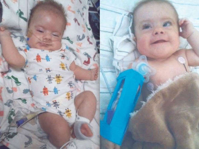 A fundraiser for Abel Lindsey, who was born prematurely with a number of medical problems, is planned by Greencastle American Legion Riders Post 373 on Saturday, July 29.