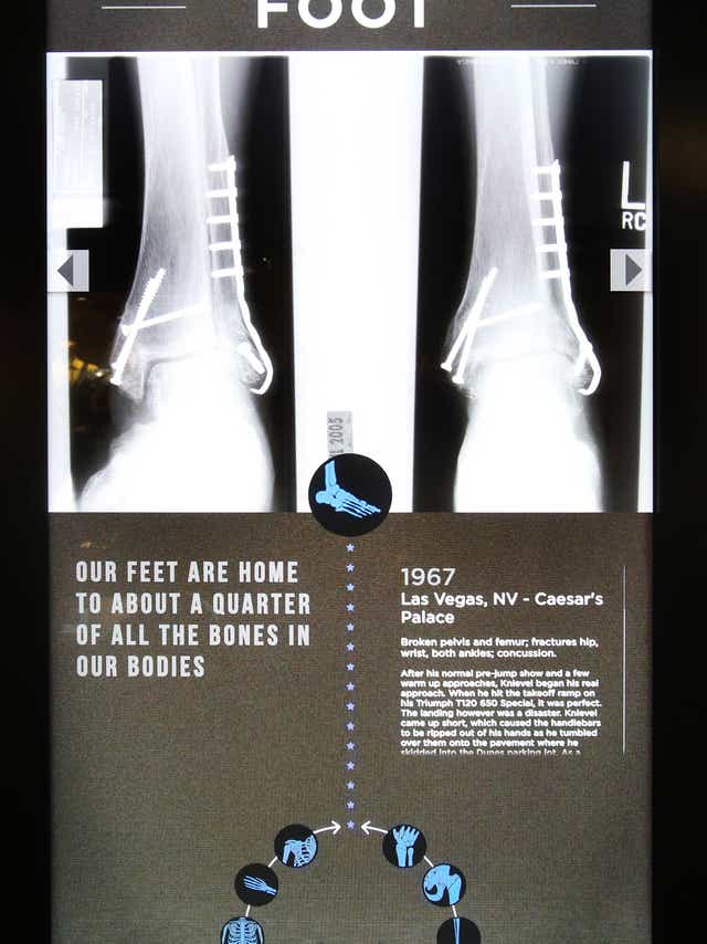 Body Of Work Evel Knievel S Injuries