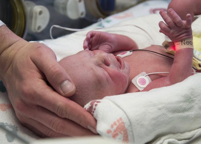 In this undated photo provided by Baylor University Medical Center the first baby born as a result of a womb transplant in the United States lies in the neonatal unit at Baylor University Medical Center in Dallas. (Baylor University Medical Center via AP)