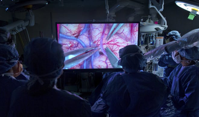 Dr. David Langer, of Lenox Hill Hospital in Manhattan, uses a videomicroscope, which provides a magnified, high-resolution 3-D image during brain surgery. Surgeons who have tested the technology predict it will change the way many brain and spine operations are performed. [Bèatrice De Gèa/The New York Times)