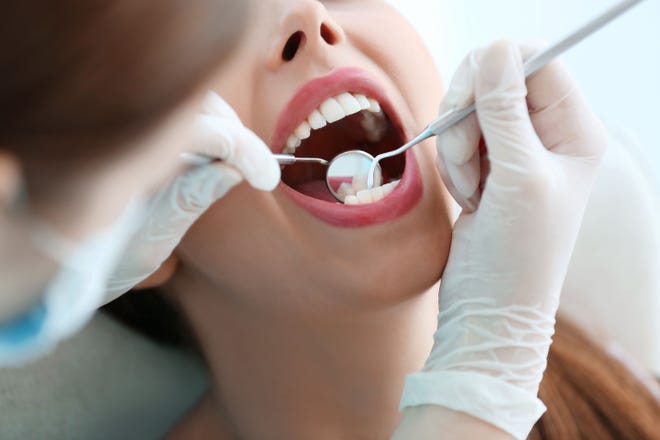 Two 2016 studies found those diagnosed with periodontal disease faced a higher risk of stroke and heart disease, said Dr. Sanda Moldovan. [Shutterstock]