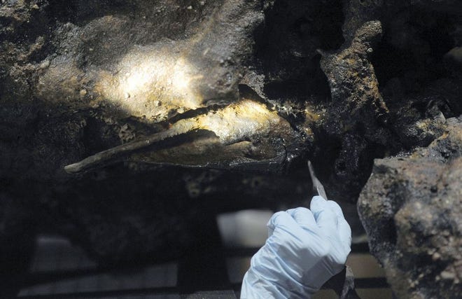 In this 2017 photo, Marie Kesten Zahn, an archaeologist and education coordinator at the Whydah Pirate Museum in West Yarmouth, probes the concretion surrounding a leg bone that was salvaged from the Whydah shipwreck off the coast of Wellfleet on Cape Cod. [File Photo/The Associated Press]