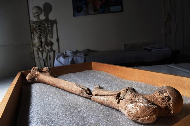 A femur with a bullet was among the limbs found at the Civil War burial pit. [Washington Post photo by Matt McClain]