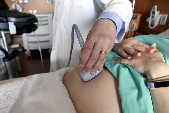 In this Aug. 7 photo, a doctor performs an ultrasound scan on a pregnant woman at a hospital in Chicago. According to a study released Wednesday, first-time mothers at low risk of complications were less likely to need a cesarean delivery if labor was induced at 39 weeks instead of waiting for it to start on its own. Their babies fared better, too. [TERESA CRAWFORD/ASSOCIATED PRESS]
