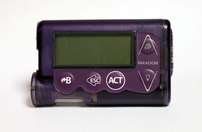 This Nov. 14, 2018 photo taken in Jackson, Miss., shows the Medtronic Paradigm REAL-Time Revel insulin pump of Polly Varnado's daughter. Medical device manufacturers and experts say insulin pumps are safe. But an AP investigation found that insulin pumps and their components are responsible for the highest number of malfunction, injury and death reports in the U.S. Food and Drug AdministrationþÄôs medical device database. (AP Photo/Rogelio V. Solis)