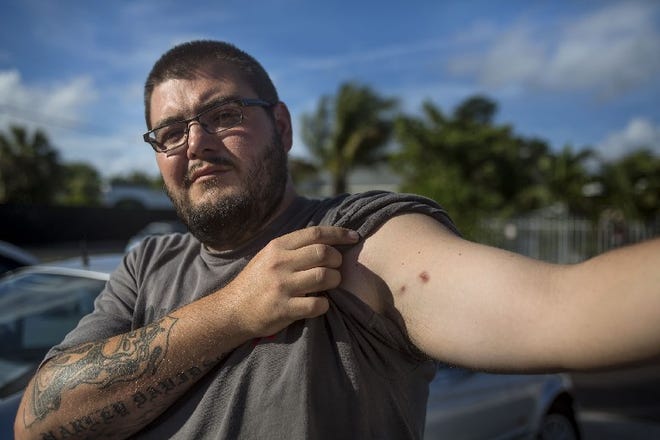 Charles Cook III shows his gunshot wounds outside Big City Towing in Boynton Beach. Cook III was shot in October during a brawl between neighboring businesses. The bullet went through his wrist, grazed his upper arm, lodged in his chest and was surgically removed from his back. The shooter will not face charges because of Florida's 'stand your ground' law, but Cook III says that the law is being misused. [JAMES WOOLDRIDGE/palmbeachpost.com]