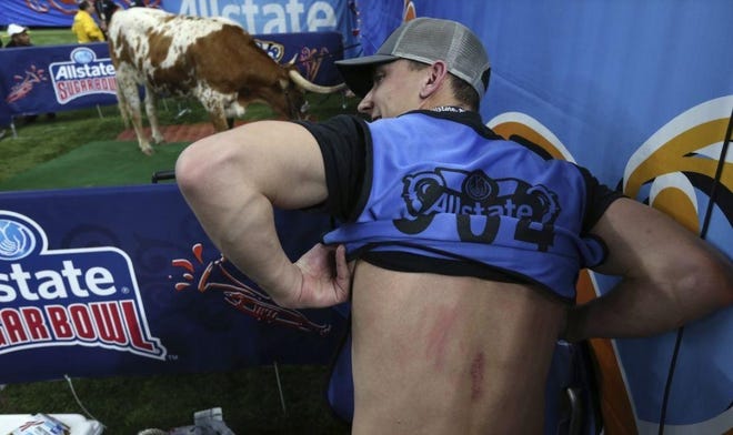 Nick Wagner shows off a bruise on his back after a run-in with Bevo.