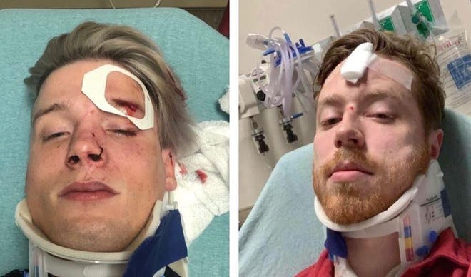 Authorities say Tristan Perry, left, and Spencer Deehring were beaten up and called homophobic slurs after leaving the Rain night club on Jan. 19. Austin police have arrested four suspects in the attack. [COURTESY OF SPENCER DEEHRING]