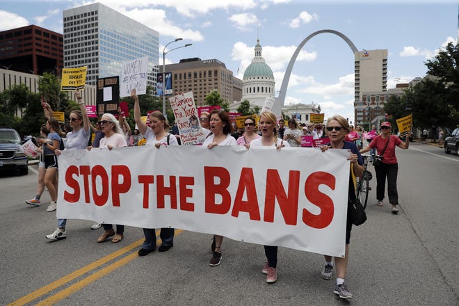 Abortion-rights supporters march on May 30 in St. Louis. [Jeff Roberson/Associated Press]