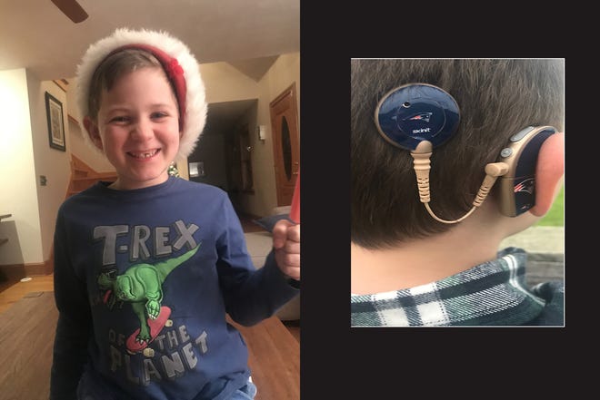 Born deaf, Benjamin Woodrup needs the cochlear implant processors to hear. One of the devices, shown right, are programmed specifically for Benjamin and would not work for anyone else. [Courtesy of Karen Oliver]