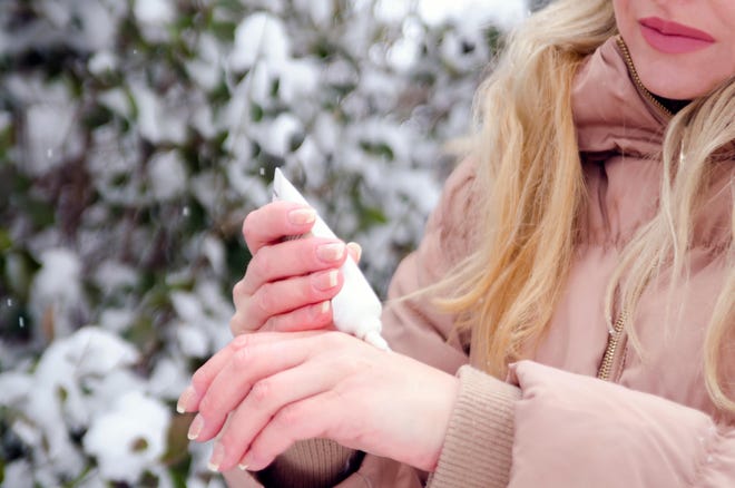 Winter can harm your skin but there are measures you can take to help it. [SHUTTERSTOCK.COM]