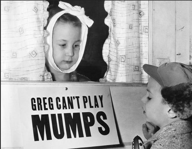 A sign on seven-year-old Greg Cox’s front door at Altamont, Ill., reads “Greg can’t play, mumps.” However, his friend Jon Douglas, six, can’t read and comes knocking on Jan. 16, 1957. (AP Photo)