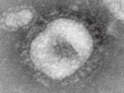 A transmission electron micrograph shows what a coronavirus molecule looks like. This image came from Dr. Linda Saif, a coronavirus expert who works at Ohio State University's Wooster Campus.